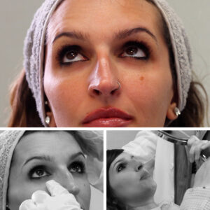 TOTAL EYES: Corrige tus ojeras hundidas