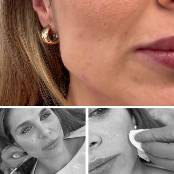 bruxismo-clinicas-diego-de-leon