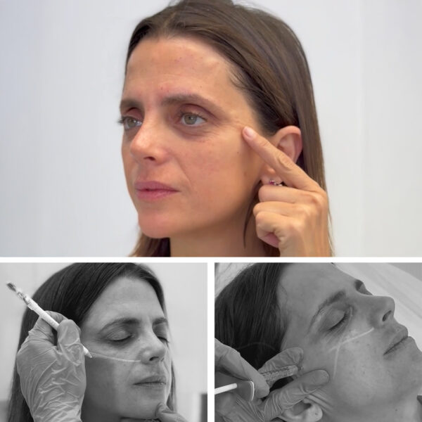 face-up-clinicasdiegodeleon