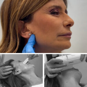 lindsay-lift-clinicas-diego-de-leon